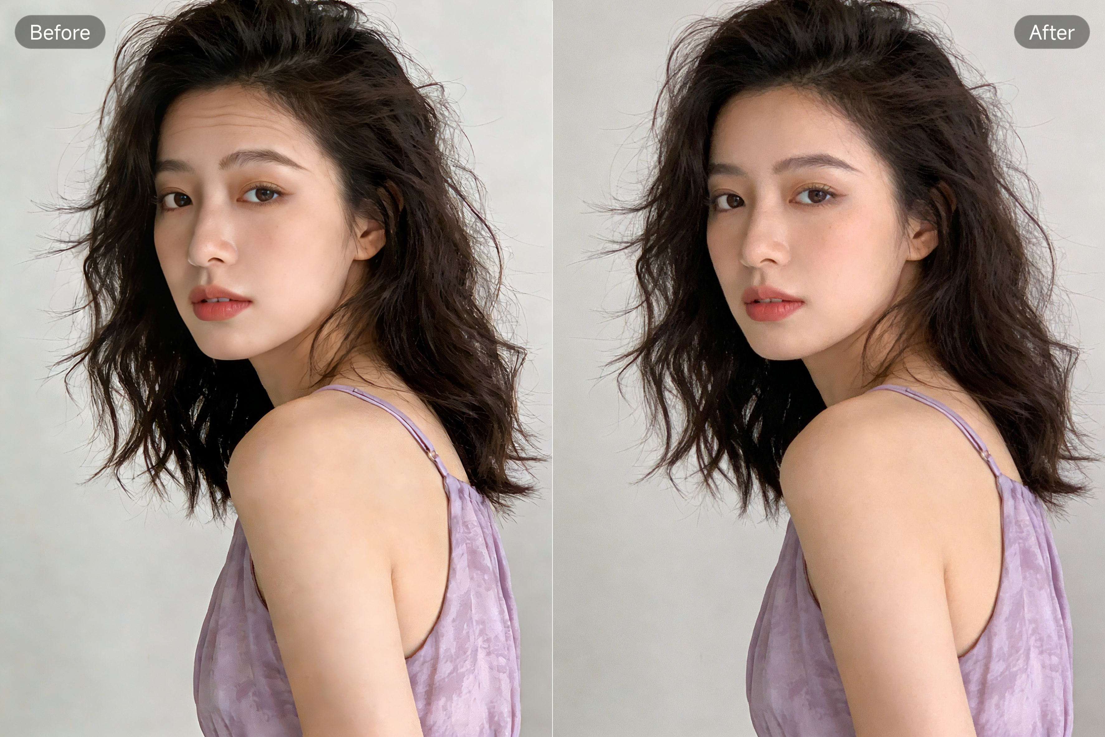 PixPretty 額のシワ除去