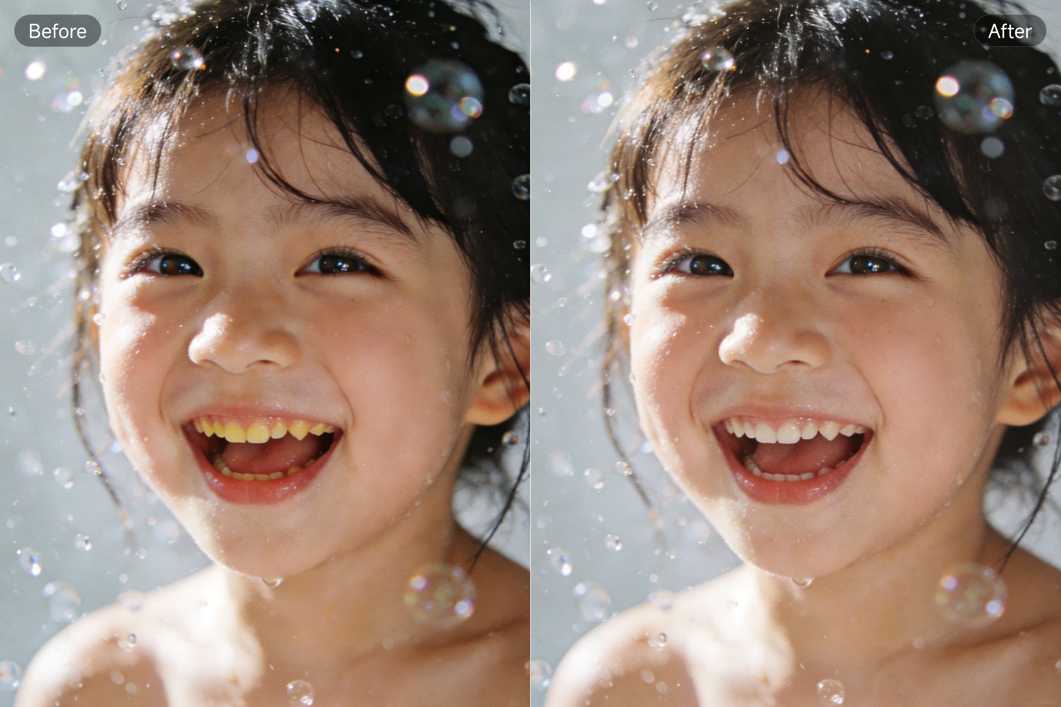 PixPretty 歯のホワイトニング