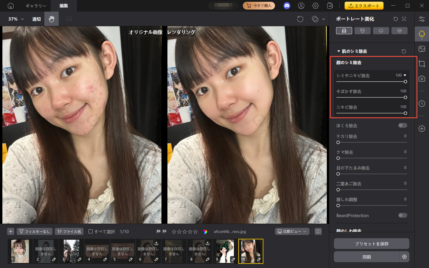 PixPretty　ニキビ除去