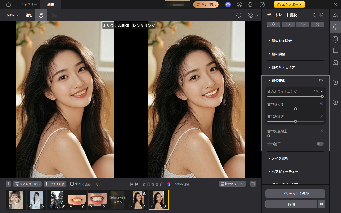 歯 白く する pixpretty